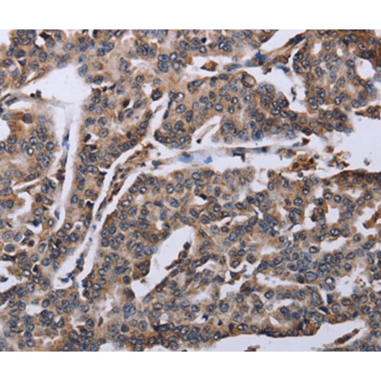 Immunohistochemistry - DDX11 Antibody from Signalway Antibody (36579) - Antibodies.com