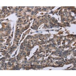 Immunohistochemistry - DDX11 Antibody from Signalway Antibody (36579) - Antibodies.com