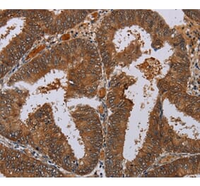 Immunohistochemistry - LCMT1 Antibody from Signalway Antibody (36582) - Antibodies.com