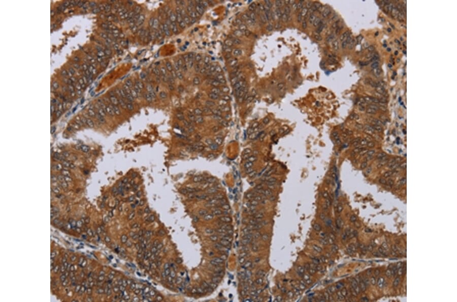 Immunohistochemistry - LCMT1 Antibody from Signalway Antibody (36582) - Antibodies.com