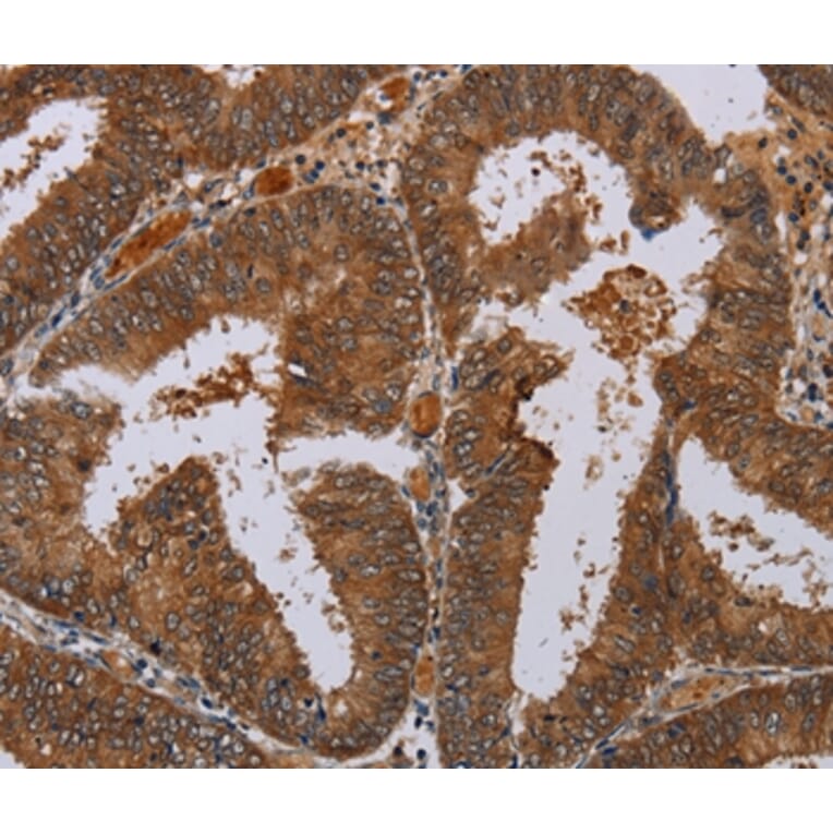 Immunohistochemistry - LCMT1 Antibody from Signalway Antibody (36582) - Antibodies.com