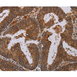 Immunohistochemistry - LCMT1 Antibody from Signalway Antibody (36582) - Antibodies.com