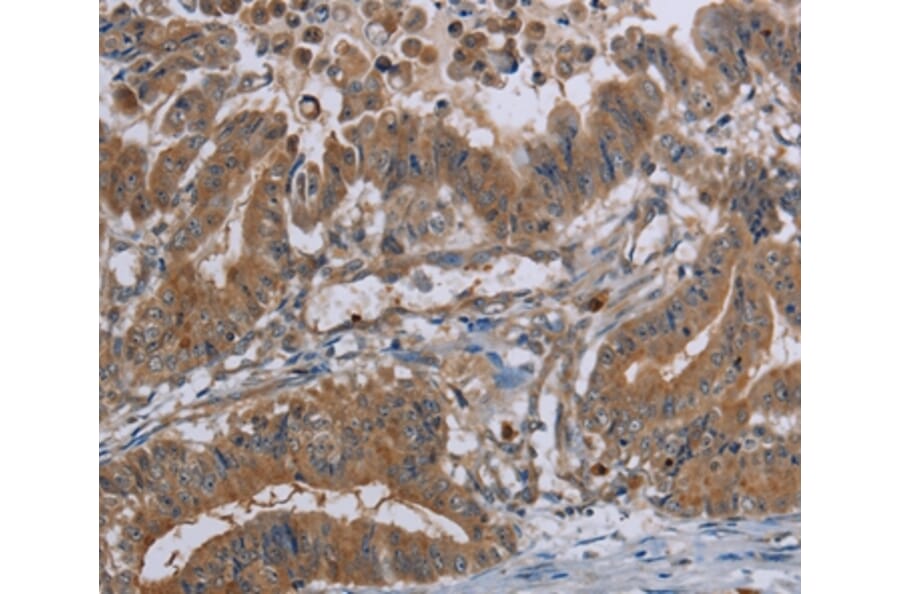 Immunohistochemistry - LCMT1 Antibody from Signalway Antibody (36582) - Antibodies.com