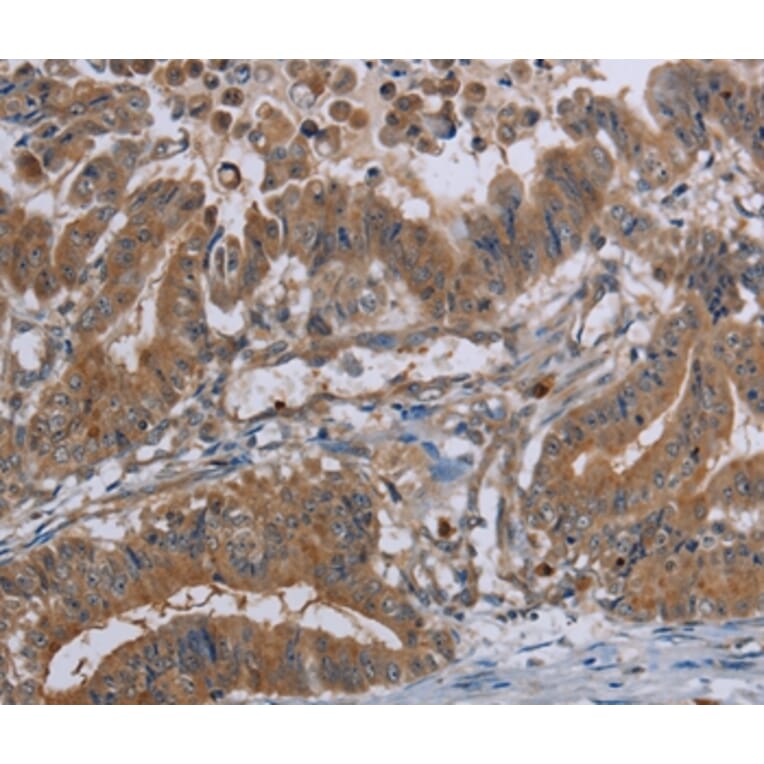 Immunohistochemistry - LCMT1 Antibody from Signalway Antibody (36582) - Antibodies.com
