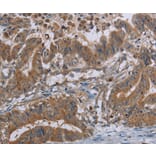 Immunohistochemistry - LCMT1 Antibody from Signalway Antibody (36582) - Antibodies.com