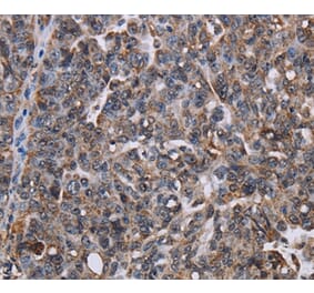 Immunohistochemistry - LDOC1 Antibody from Signalway Antibody (36583) - Antibodies.com