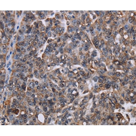 Immunohistochemistry - LDOC1 Antibody from Signalway Antibody (36583) - Antibodies.com