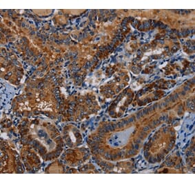 Immunohistochemistry - PIDD1 Antibody from Signalway Antibody (36588) - Antibodies.com
