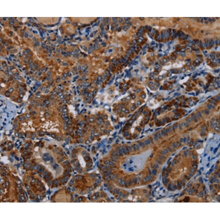 Immunohistochemistry - PIDD1 Antibody from Signalway Antibody (36588) - Antibodies.com
