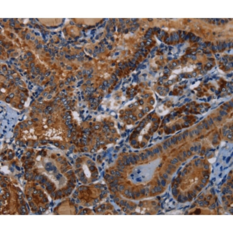 Immunohistochemistry - PIDD1 Antibody from Signalway Antibody (36588) - Antibodies.com