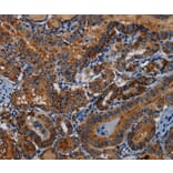 Immunohistochemistry - PIDD1 Antibody from Signalway Antibody (36588) - Antibodies.com