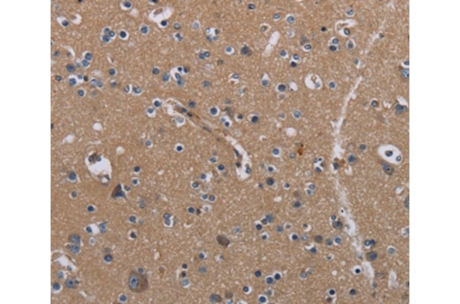 Immunohistochemistry - PIDD1 Antibody from Signalway Antibody (36588) - Antibodies.com