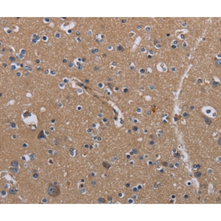 Immunohistochemistry - PIDD1 Antibody from Signalway Antibody (36588) - Antibodies.com