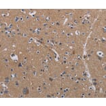 Immunohistochemistry - PIDD1 Antibody from Signalway Antibody (36588) - Antibodies.com