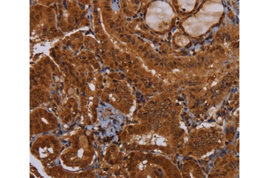 Immunohistochemistry - WDR83 Antibody from Signalway Antibody (36600) - Antibodies.com