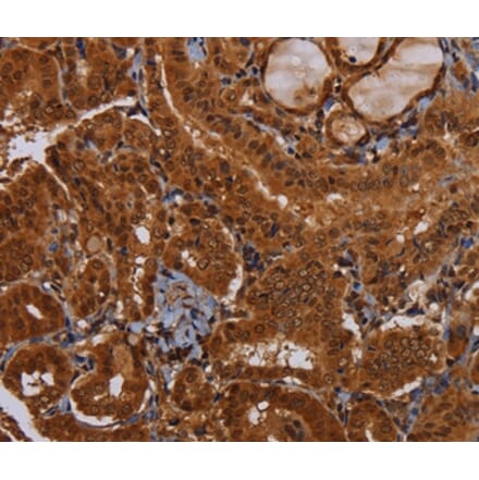 Immunohistochemistry - WDR83 Antibody from Signalway Antibody (36600) - Antibodies.com