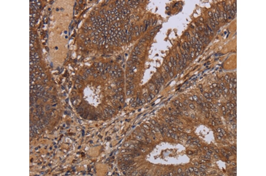 Immunohistochemistry - WDR83 Antibody from Signalway Antibody (36600) - Antibodies.com