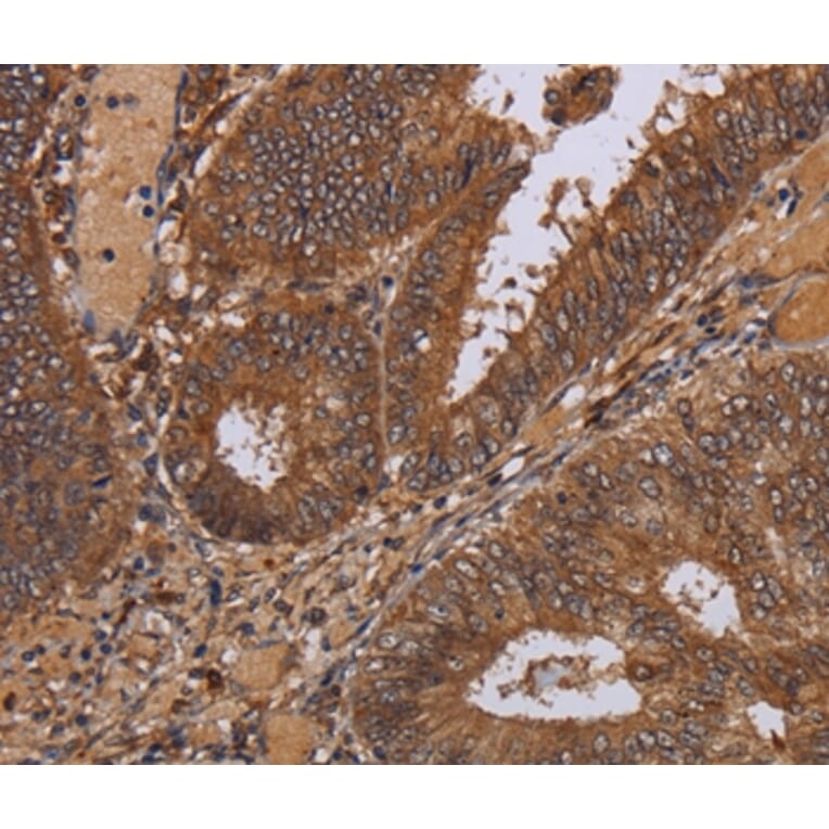 Immunohistochemistry - WDR83 Antibody from Signalway Antibody (36600) - Antibodies.com