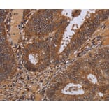 Immunohistochemistry - WDR83 Antibody from Signalway Antibody (36600) - Antibodies.com