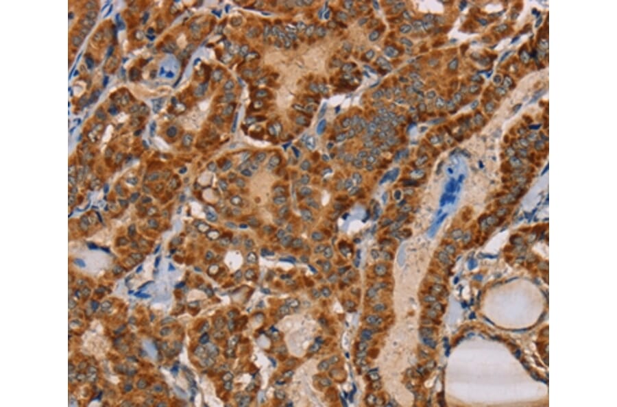 Immunohistochemistry - MBNL3 Antibody from Signalway Antibody (36603) - Antibodies.com