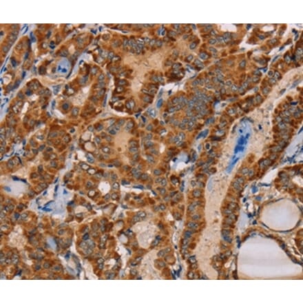 Immunohistochemistry - MBNL3 Antibody from Signalway Antibody (36603) - Antibodies.com