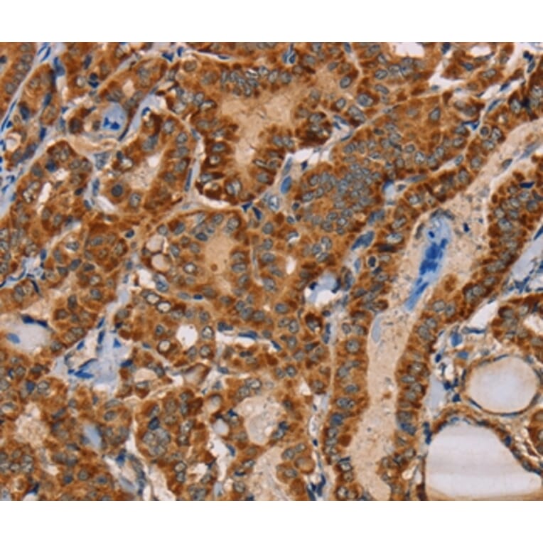 Immunohistochemistry - MBNL3 Antibody from Signalway Antibody (36603) - Antibodies.com