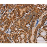 Immunohistochemistry - MBNL3 Antibody from Signalway Antibody (36603) - Antibodies.com
