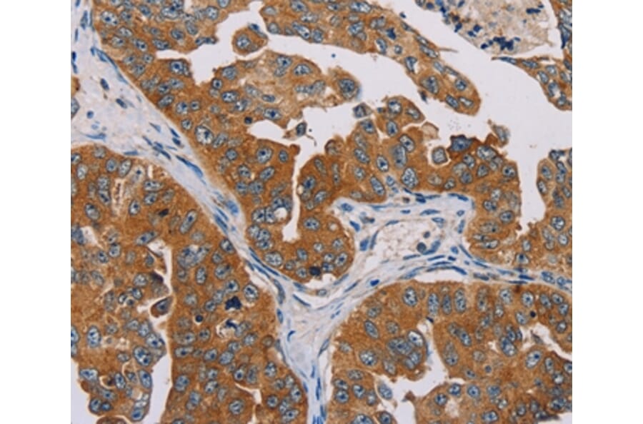 Immunohistochemistry - MBNL3 Antibody from Signalway Antibody (36603) - Antibodies.com