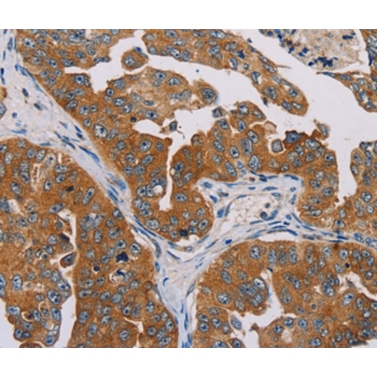 Immunohistochemistry - MBNL3 Antibody from Signalway Antibody (36603) - Antibodies.com