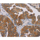 Immunohistochemistry - MBNL3 Antibody from Signalway Antibody (36603) - Antibodies.com