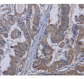 Immunohistochemistry - TRPM8 Antibody from Signalway Antibody (36613) - Antibodies.com