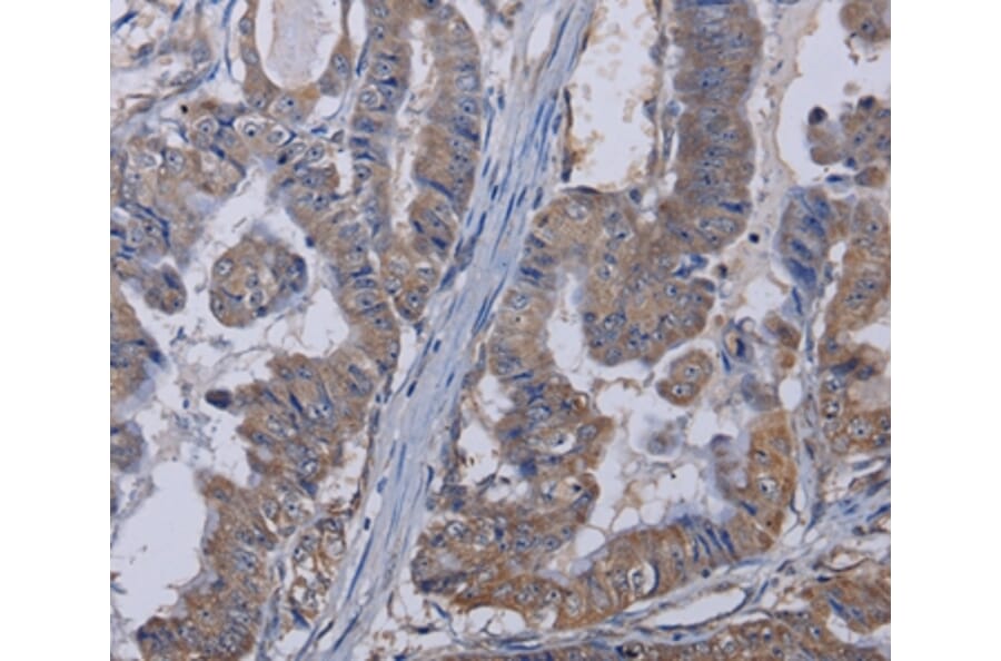 Immunohistochemistry - TRPM8 Antibody from Signalway Antibody (36613) - Antibodies.com