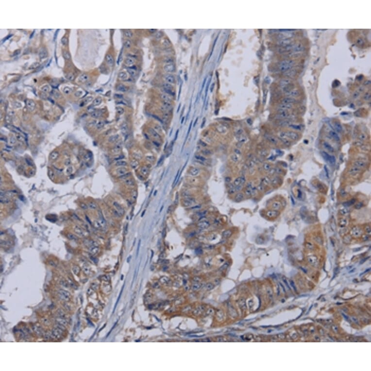 Immunohistochemistry - TRPM8 Antibody from Signalway Antibody (36613) - Antibodies.com