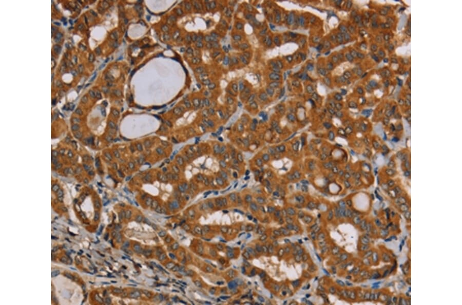 Immunohistochemistry - CENPU Antibody from Signalway Antibody (36620) - Antibodies.com