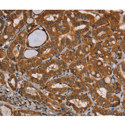 Immunohistochemistry - CENPU Antibody from Signalway Antibody (36620) - Antibodies.com