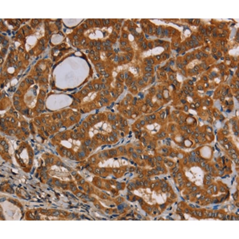 Immunohistochemistry - CENPU Antibody from Signalway Antibody (36620) - Antibodies.com