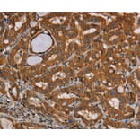 Immunohistochemistry - CENPU Antibody from Signalway Antibody (36620) - Antibodies.com