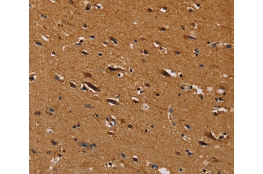 Immunohistochemistry - CENPU Antibody from Signalway Antibody (36620) - Antibodies.com