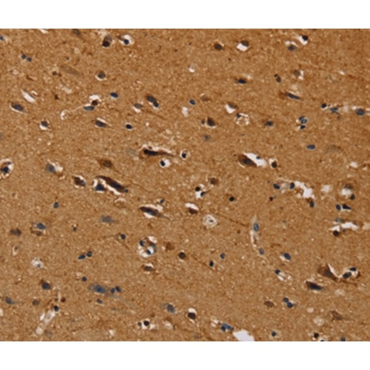 Immunohistochemistry - CENPU Antibody from Signalway Antibody (36620) - Antibodies.com