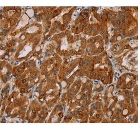 Immunohistochemistry - MTUS1 Antibody from Signalway Antibody (36626) - Antibodies.com