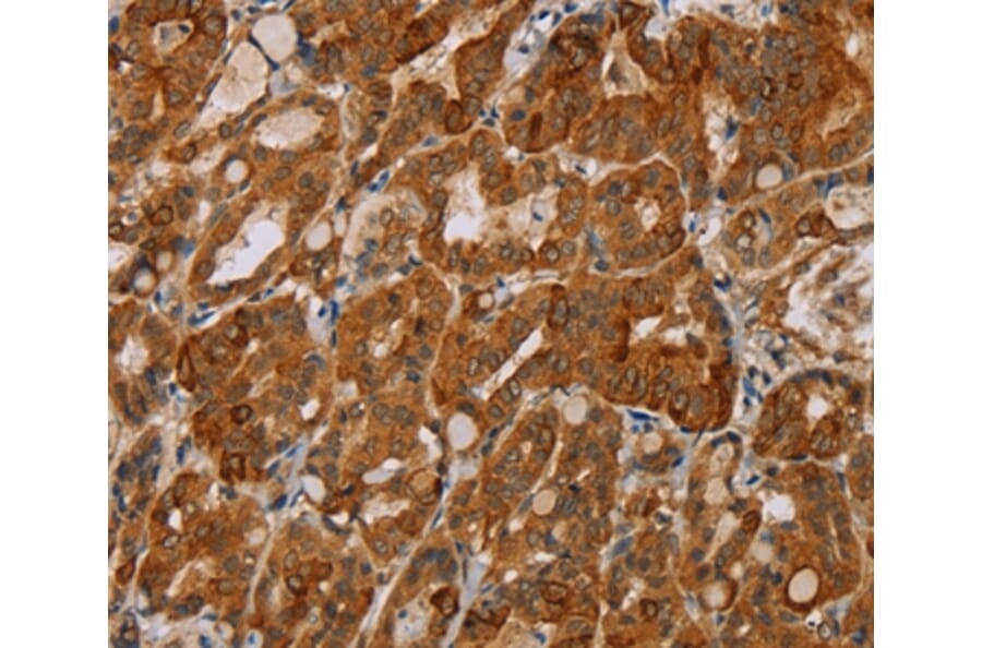 Immunohistochemistry - MTUS1 Antibody from Signalway Antibody (36626) - Antibodies.com