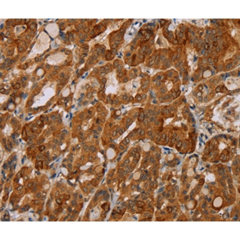 Immunohistochemistry - MTUS1 Antibody from Signalway Antibody (36626) - Antibodies.com