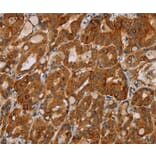 Immunohistochemistry - MTUS1 Antibody from Signalway Antibody (36626) - Antibodies.com