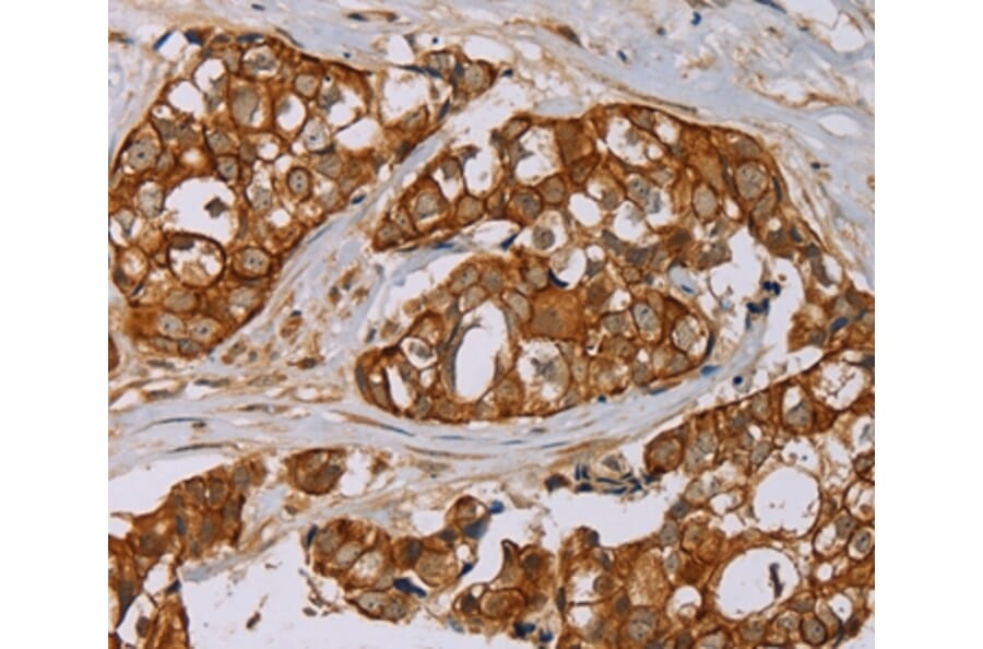 Immunohistochemistry - MTUS1 Antibody from Signalway Antibody (36626) - Antibodies.com