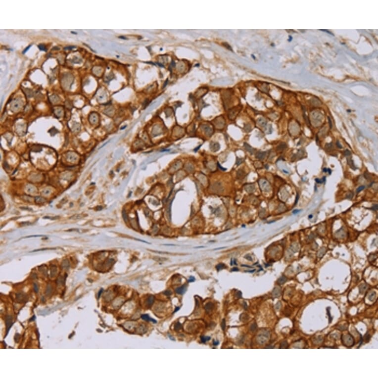 Immunohistochemistry - MTUS1 Antibody from Signalway Antibody (36626) - Antibodies.com