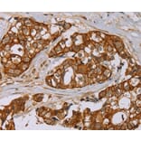 Immunohistochemistry - MTUS1 Antibody from Signalway Antibody (36626) - Antibodies.com