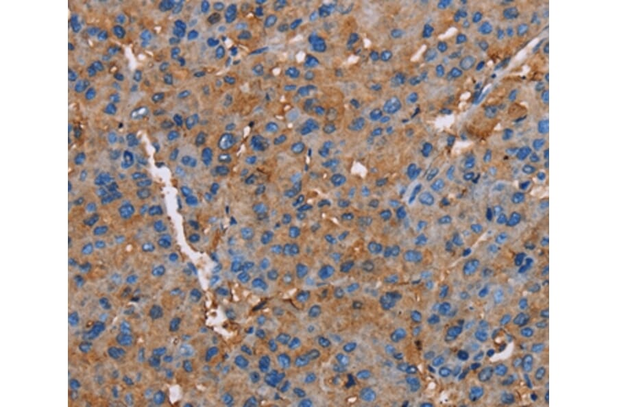 Immunohistochemistry - NLGN1 Antibody from Signalway Antibody (36650) - Antibodies.com