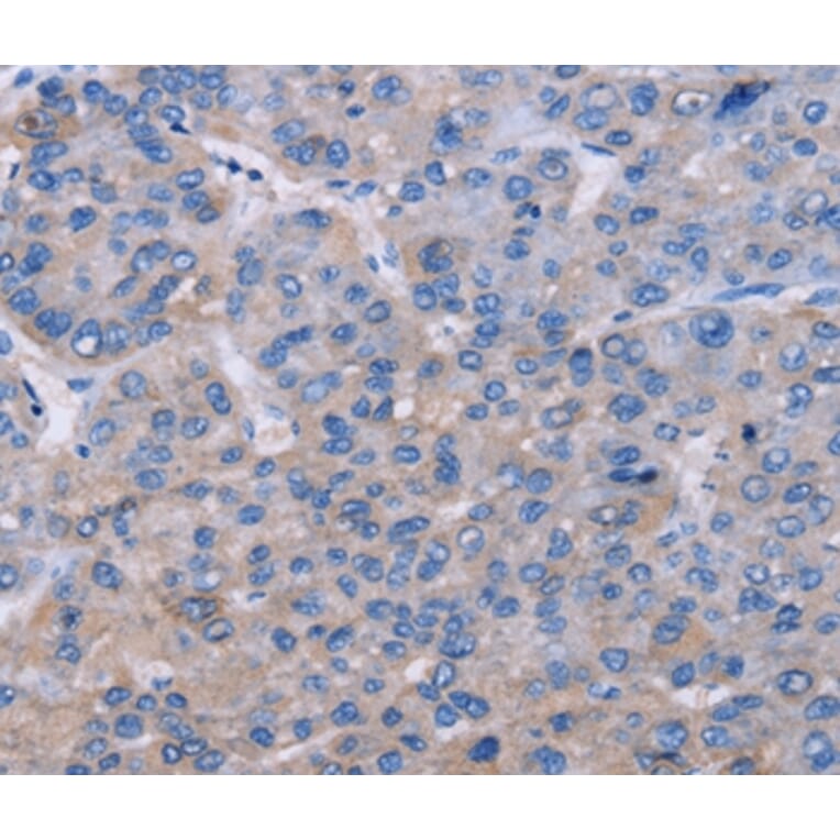 Immunohistochemistry - NR1D1 Antibody from Signalway Antibody (36659) - Antibodies.com