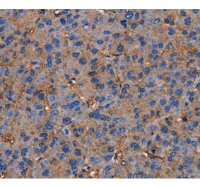 Immunohistochemistry - NRIP3 Antibody from Signalway Antibody (36660) - Antibodies.com