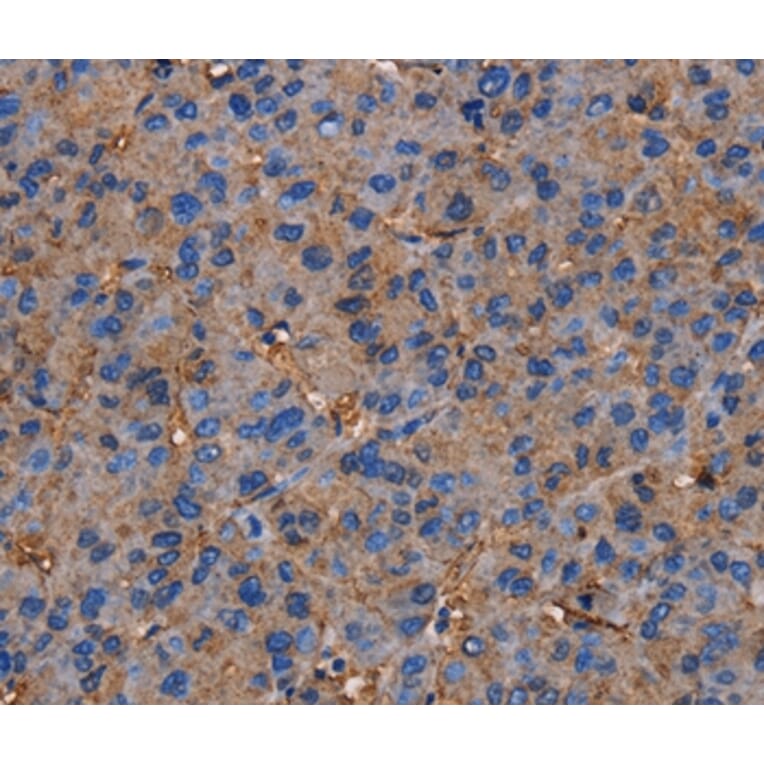 Immunohistochemistry - NRIP3 Antibody from Signalway Antibody (36660) - Antibodies.com